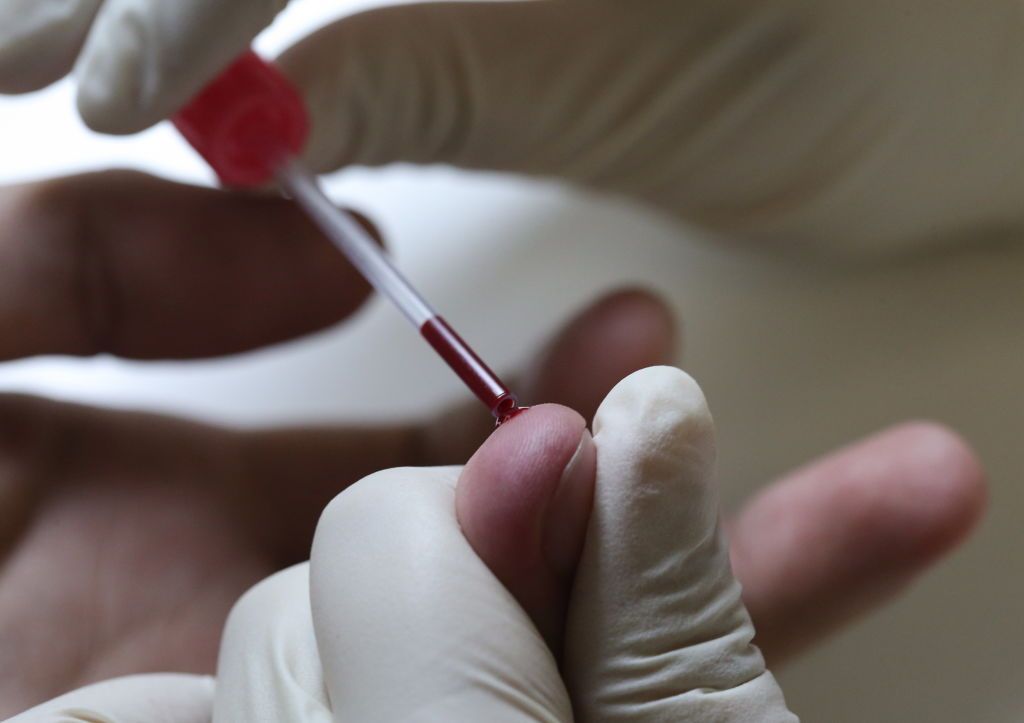 MOSCOW, RUSSIA - OCTOBER 24, 2018: Defining a donor's blood type for a blood donation marathon held at Moscow's City Clinical Hospital No 52 to mark the 200th anniversary of the first blood transfusion. Vladimir Gerdo/TASS (Photo by Vladimir GerdoTASS via Getty Images)